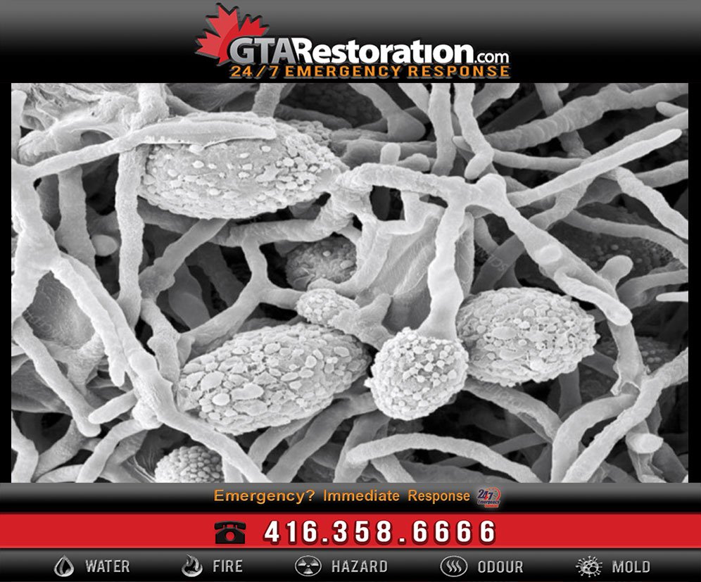 Pithomyces-Chartarum-Fungus-Mold-Spores